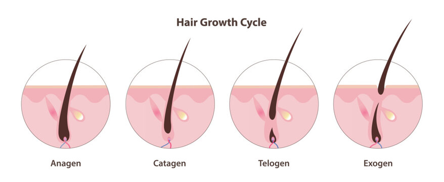 Hair growth cycle vector icon set illustration. Hair grows in four distinct stages. Anagen, growing phase. Catagen, transition phase. Telogen, resting phase. Exogen, shedding phase. Hair care concept.