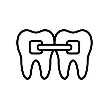 Orthodontic dental braces on teeth.