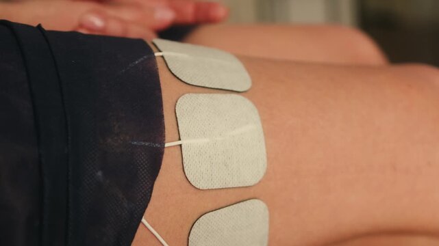 Patient undergoing physiotherapy with electrical stimulation in a medical center. Electrodes attached to the leg for pain relief, muscle recovery and rehabilitation after injury. High quality 4k