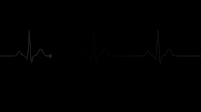 Black heartbeat pulse line with monitor sweep effect, transparent background loop animation