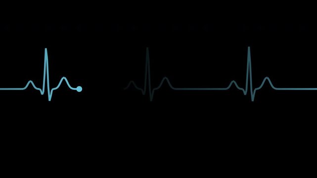 Blue heartbeat pulse line with monitor sweep effect, transparent background loop animation