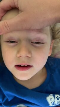 Parent checking injured eye of a child with subconjunctival hemorrhage. Concerned caregiver examining bloodshot eyelid of toddler. Health and injury care concept.