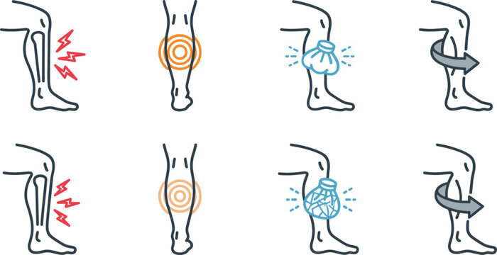  Leg pain vector icon set featuring calf muscle injury shin splints cramp ice compress therapy and stretching guidelines