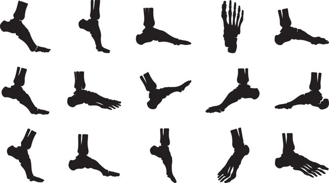 Set of human foot bone anatomy silhouettes in various positions isolated.