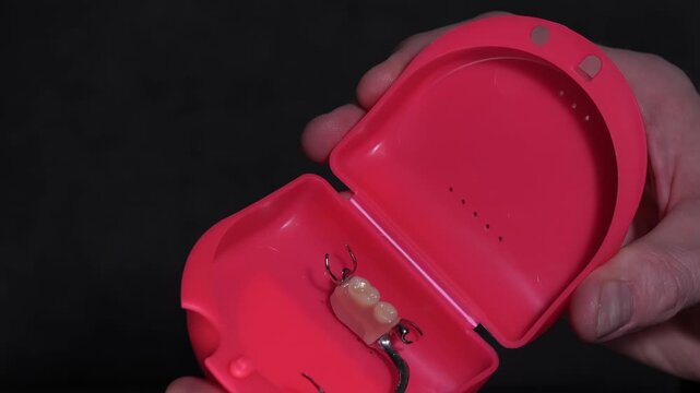 Close-up view of hands holding a bright red case containing a dental prosthesis, showcasing the intricate details of the prosthetic and the case's interior design and color