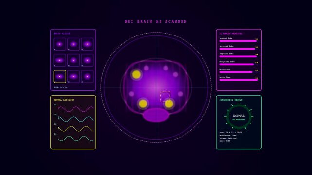 A futuristic AI Medical Diagnostics interface displays real time brain scan data processing through a series of animated holographic panels showing active neural activity and metrics