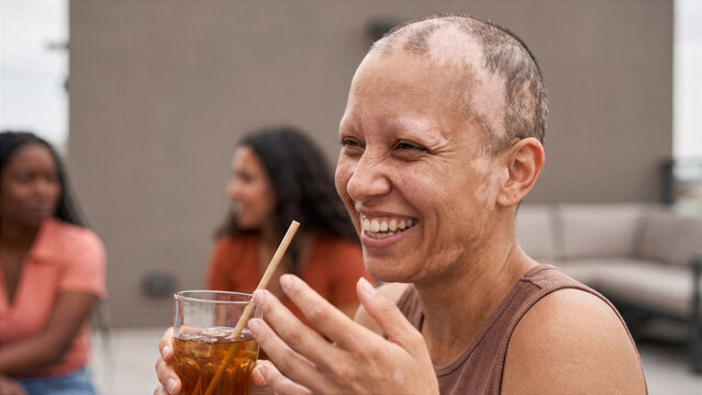 Close up of person with alopecia smiling over glass of iced tea during modern minimal roof party