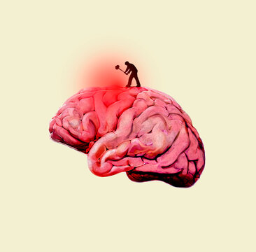 Man with sledgehammer hitting oversized brain against yellow background