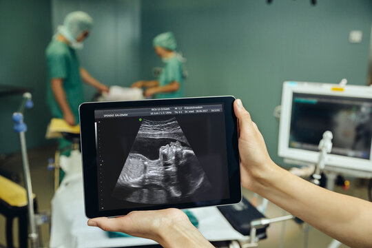 Hands holding a digital tablet showing an ultrasound image of a fetus in surgery room