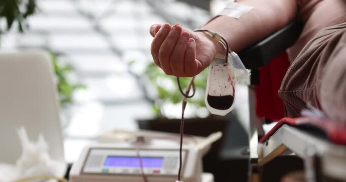 Blood donor hand detail during blood donation procedure