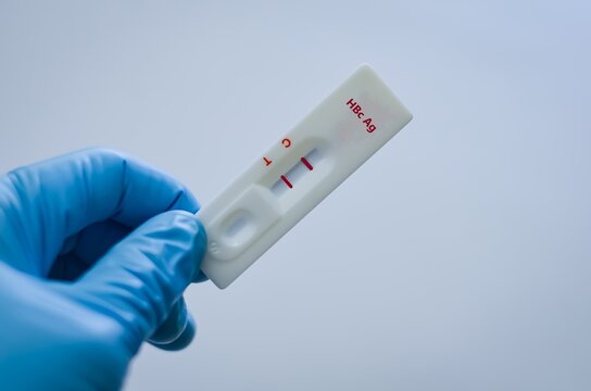 Blood sample of patient positive result for HBc Ag.