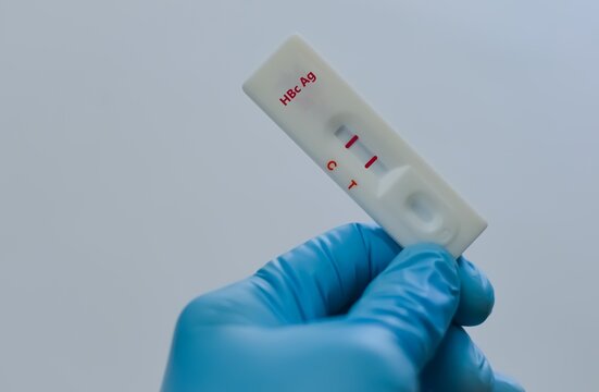 Blood sample of patient positive result for HBc Ag.