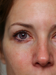 Naklejka premium Close-up of a human eye with unique purple-brown iris and detailed skin texture, showcasing intricate facial features.