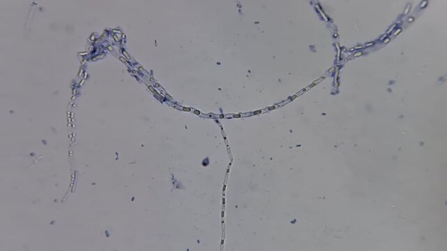 Microscopic view of pink oyster mushroom Pleurotus djamor mycelium contaminated with bacteria or mold