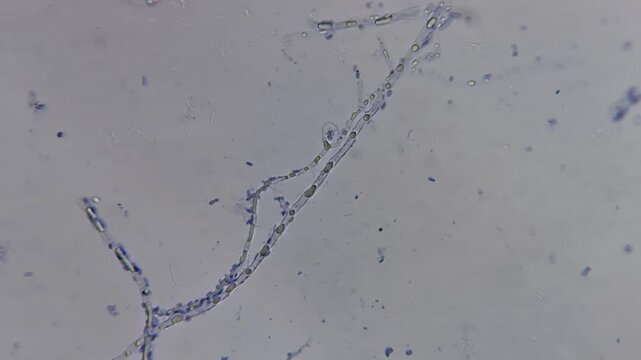 Microscopic view of pink oyster mushroom Pleurotus djamor mycelium contaminated with bacteria or mold