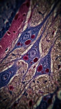 Cellular pathology view: rabies disease, rhabdovirus infect, rabies virus, neural tissue, microscopic detail, negri body, brain cell, pathogen spread, medical research, cell damage.