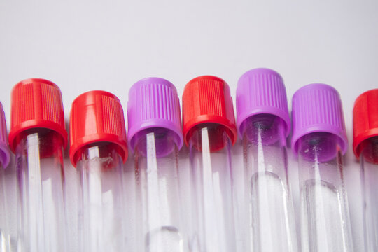 Close-up, high-angle shot of several empty medical blood collection tubes with alternating red and purple caps, arranged in a row against a light background.