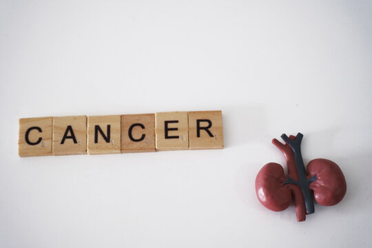Kidney cancer concept. The anatomical shape of the kidney is located near the word cancer isolated on a white background. Diagnosis and treatment of kidney and adrenal cancer.