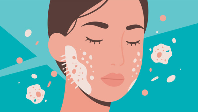 Illustration Of Exfoliating Dead Skin Cells Vector Design Template