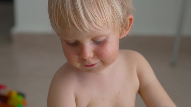 Child skin covered with tiny red dots and rash. Close-up. Slow motion.