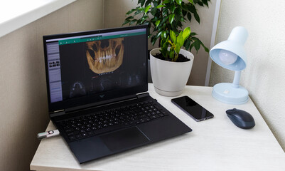 Laptop screen displaying professional dental diagnostic software with a 3D panoramic jawbone model and cross-sectional root slices. Dental © Four_Lakes