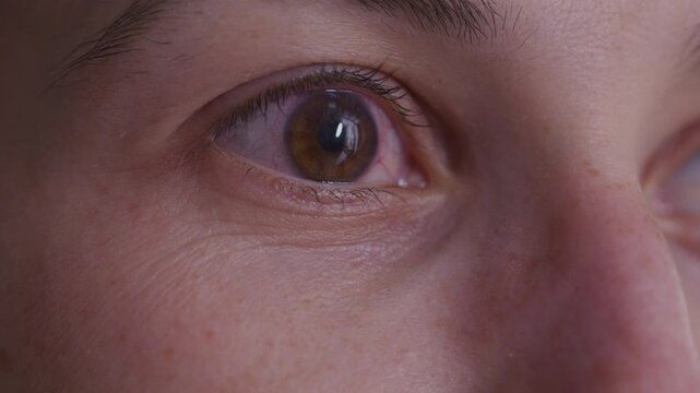 Woman with eye infection - isolated eye extreme close up seeing spot on cornea