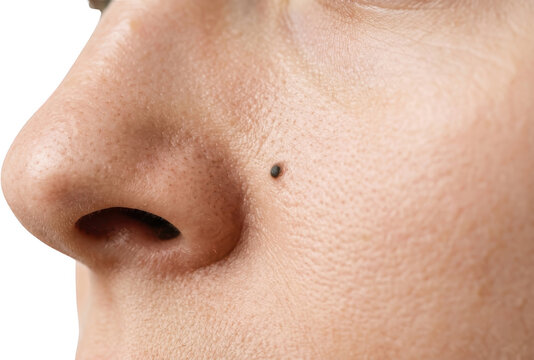 Extreme close up of a human nose showing pores and a single black mole on the cheek detail of skin texture nevus dermatology beauty imperfection skincare macro body health