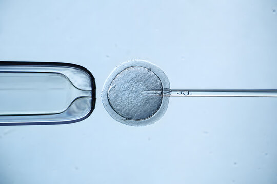 Microscopic Fertilization Procedure With Egg And Micropipettes