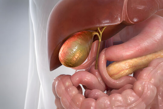 Swollen Gallbladder Beneath Liver Medical Cutaway Render