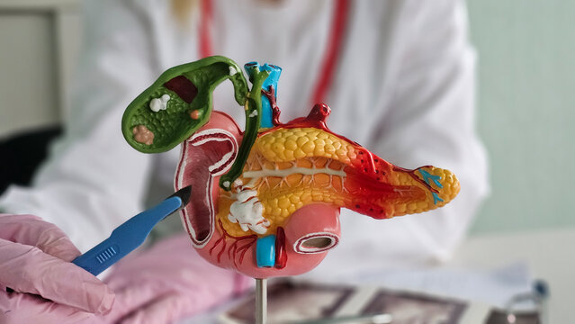 Pancreatitis and pancreatic cancer: surgeon's scalpel and pancreatic surgery, gallbladder surgery, and bile duct surgery