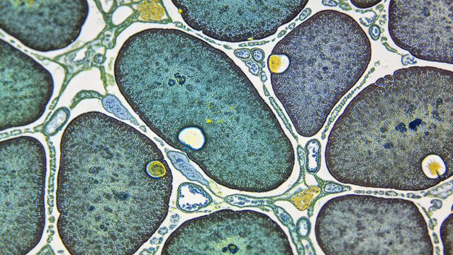 Confocal micrograph of human hepatic stellate cells, perisinusoidal location, liver research microscopy