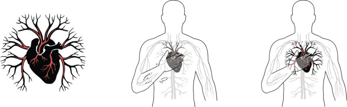 Heart Attack, Heart Disease Concept