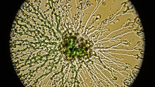 Microscopic Close-up of Spiky Green Spores or Algae Cells