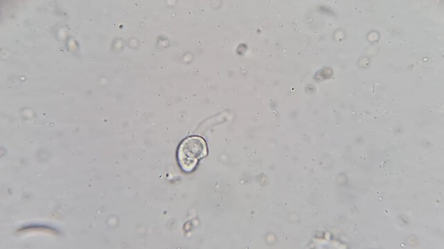 Microscopic view of Colpoda ciliate protozoan swimming in freshwater