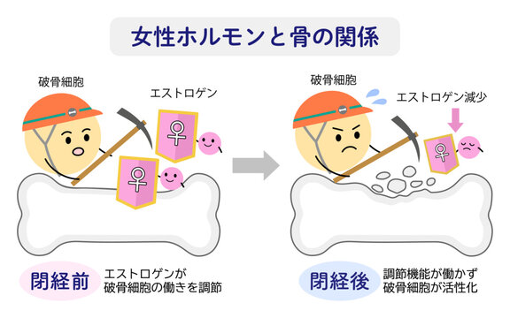 女性ホルモンのエストロゲンと骨密度の関係を表すイラスト