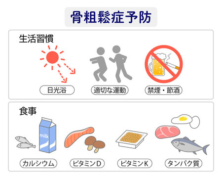 骨粗鬆症予防のための生活習慣を表すイラスト
