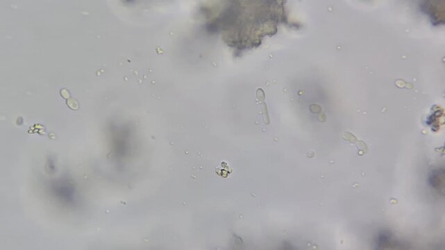 Microscopic view of yeast contamination in cream cheese, budding yeast cells under microscope close up