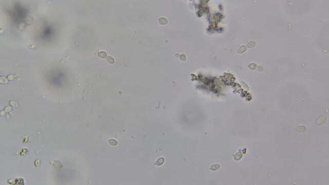 Microscopic view of yeast contamination in cream cheese, budding yeast cells under microscope close up