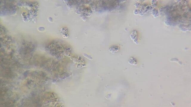 Microscopic view of yeast contamination in cream cheese, budding yeast cells under microscope close up