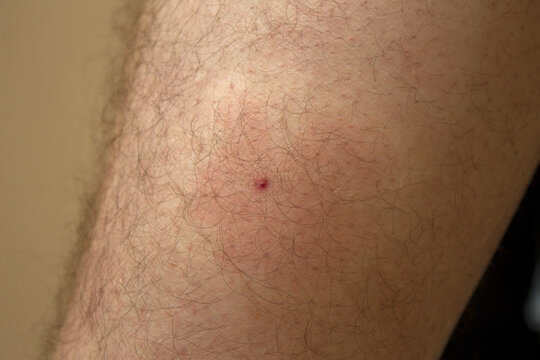 midge parasites