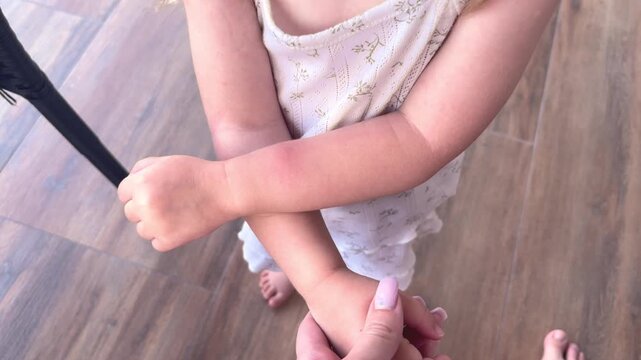 Child scratching an insect bite causing redness and irritation on arm skin