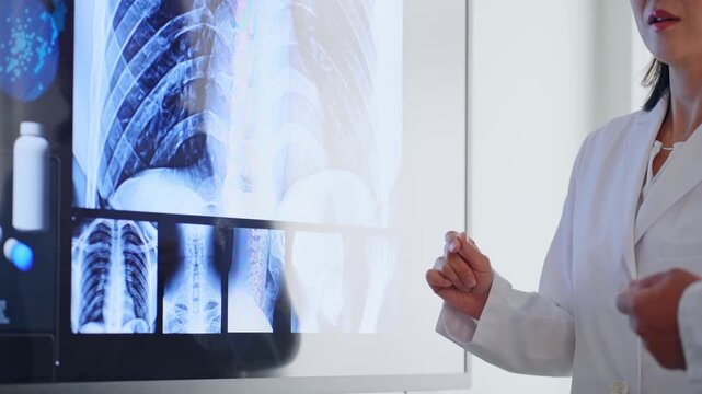 A group of male and female doctors holding a meeting while looking at a screen. Doctors, medical care, hospital, treatment, conference, clinical practice, diagnosis, surgery.