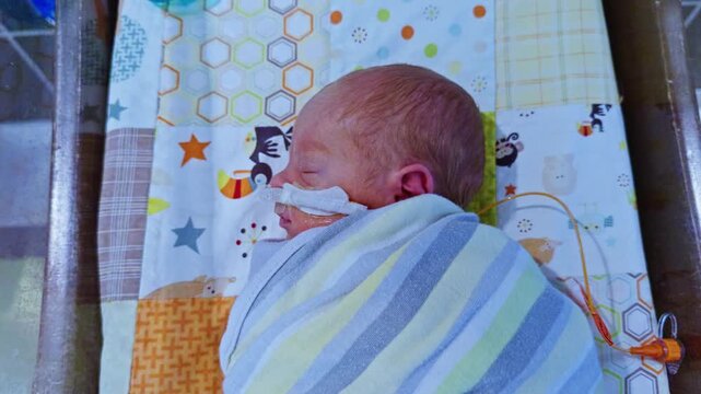 Premature newborn baby sleeping in a NICU bassinet with a nasal cannula and medical tubing while swaddled in a striped blanket. Fixed shot