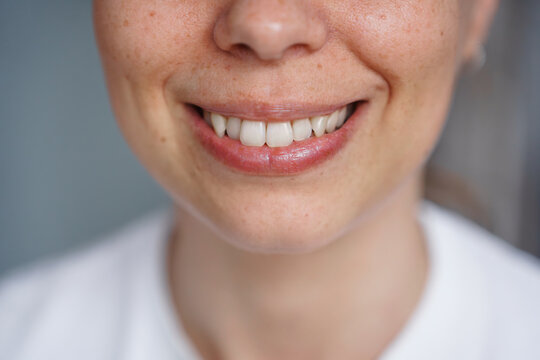 Detailed close up of young womans lower face with a gentle, authentic smile, clear skin with natural freckles on nose and cheeks, skincare beauty, authentic emotion, happy youth lifestyle concept