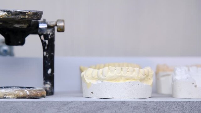 Dental casts placed on the table. The casts are made of plaster and represent models of the upper and lower jaw