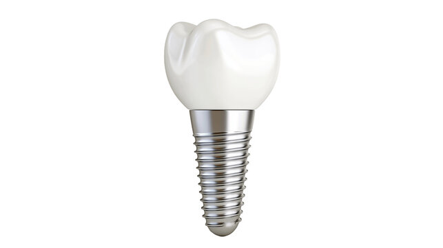 Dental implant with white crown and metallic screw base