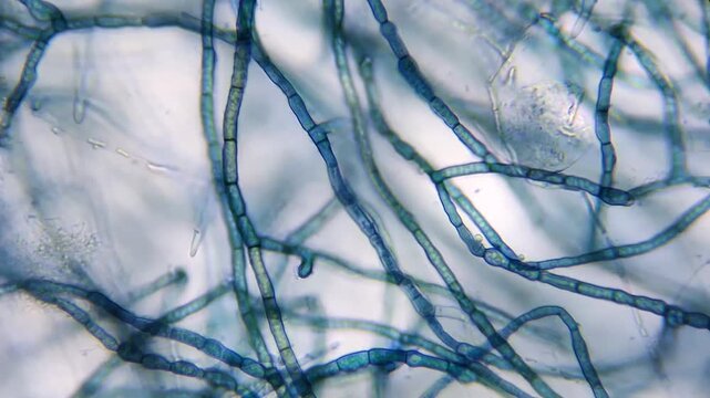 Microscopic view of contaminated Pleurotus djamor mycelium hyphae stained with methylene blue
