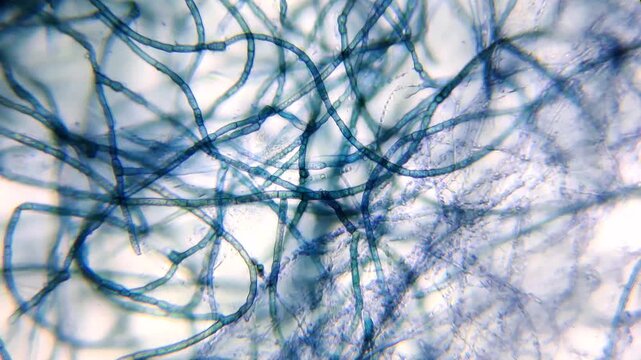 Microscopic view of contaminated Pleurotus djamor mycelium hyphae stained with methylene blue