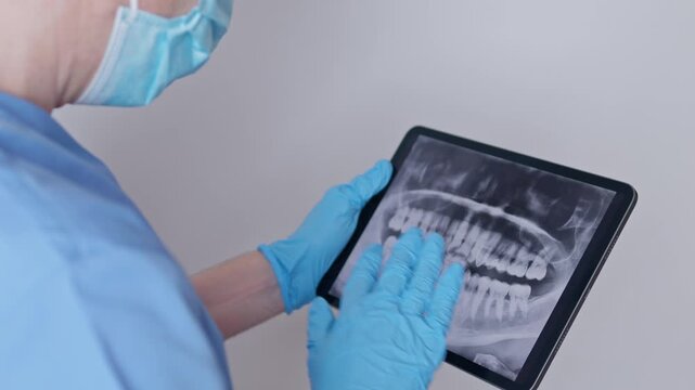 Dentist examining teeth x-ray on tablet