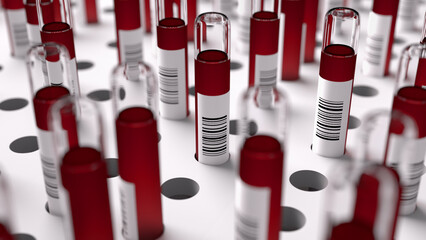 Blood collection tubes with red caps and barcode labels stand upright in a white tray with circular indentations. © Piotr Adamczyk